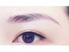激光洗眉的八大优势