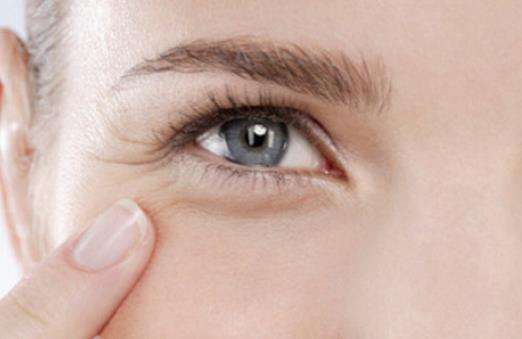 眼部皱纹形成的原因以及淡化的方法