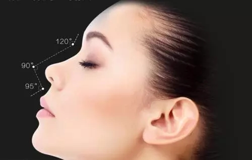 上海硅胶隆鼻效果能保持多久