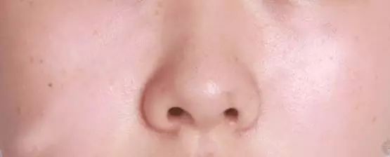 9月15日-16日，美莱集团鼻整形技术总监亲诊上海美莱！