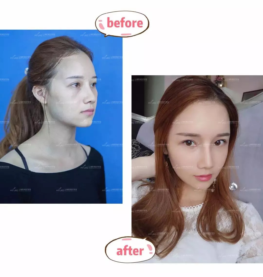 <a href='/' target='_blank'><u>上海美莱</u></a>案例