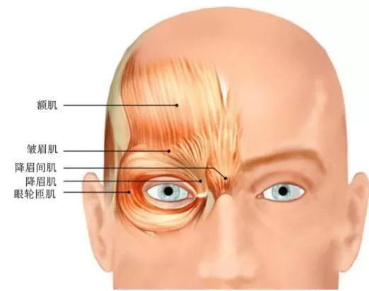 你有眉间纹吗？去除眉间纹的方法有哪些