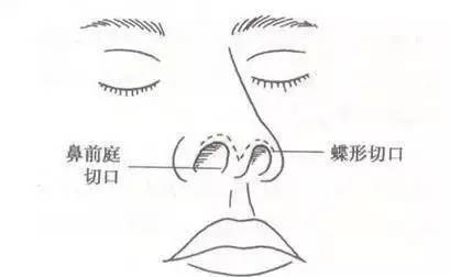 上海美莱隆鼻，塑造三位一体全方位立体美鼻！