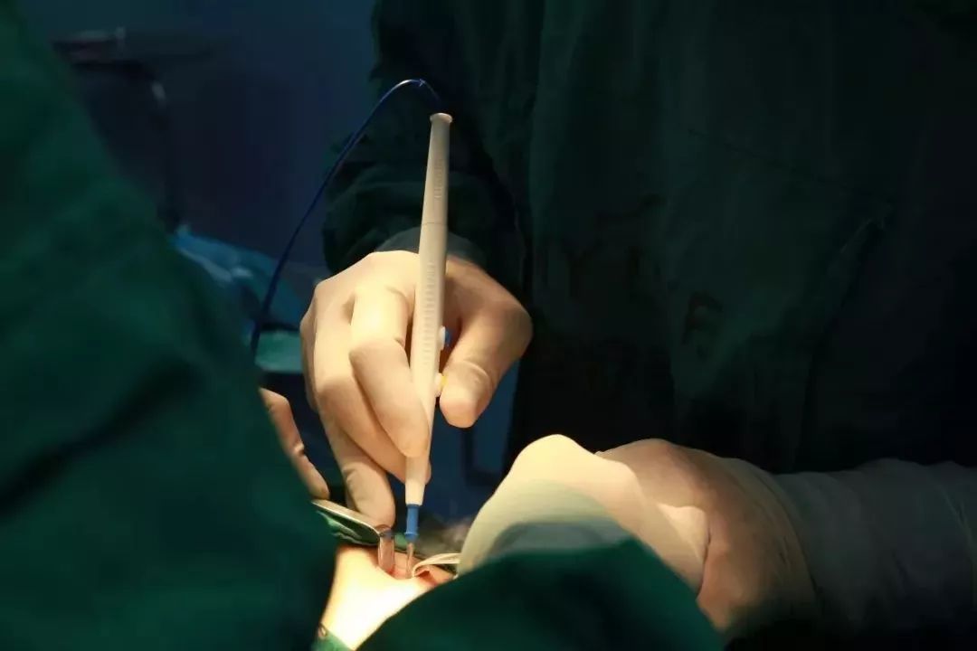 上海美莱肋软骨隆鼻整形手术的优势