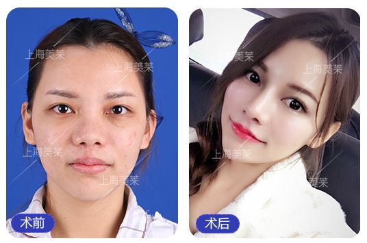 上海美莱案例