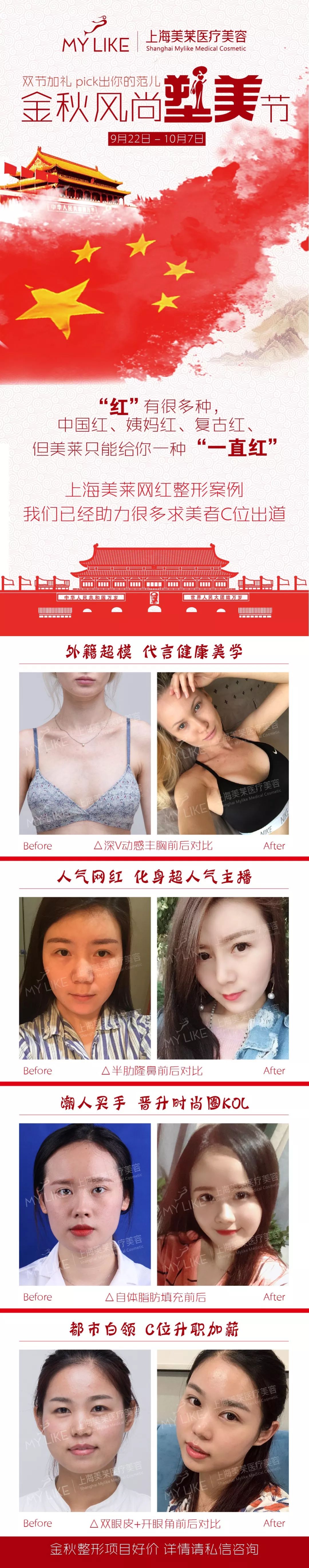 上海美莱案例