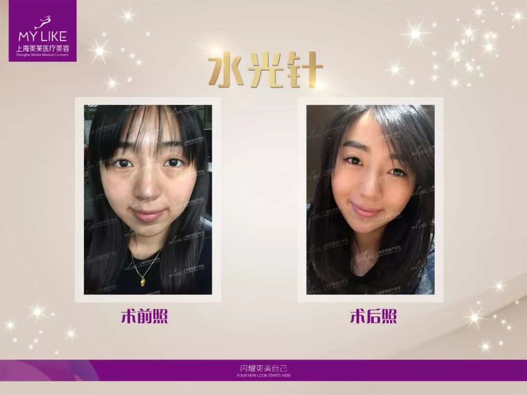 上海美莱案例