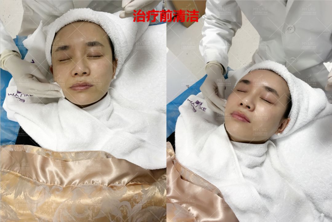 美莱20th年度盛典，助你摆脱秋冬换季的“干”尬