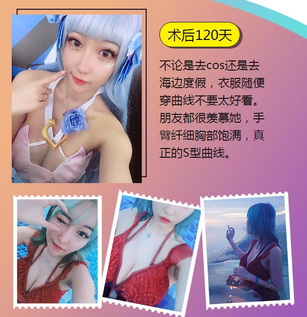 上海美莱假体丰胸案例