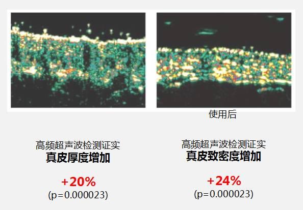 润百颜水光上海美莱怎么样