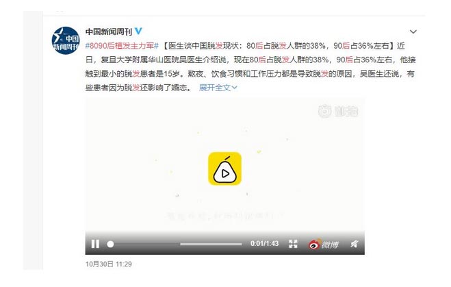 美莱周年庆植发全线6折，到院送多重礼