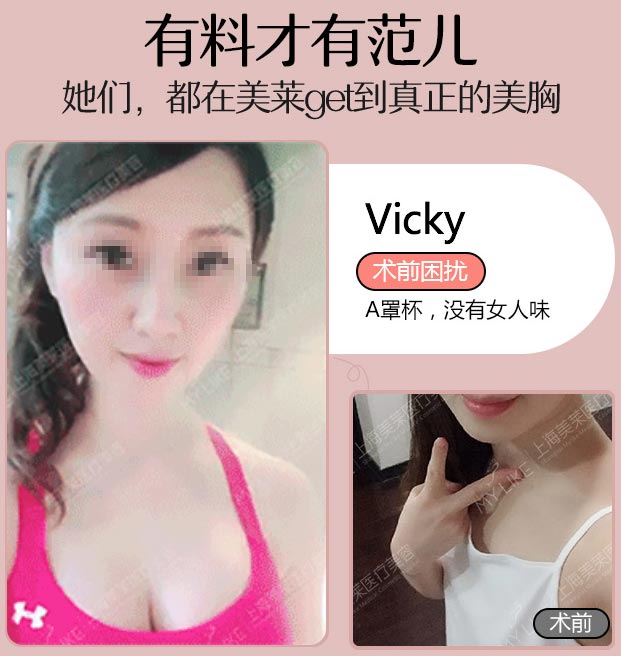 上海美莱汪灏隆胸案例