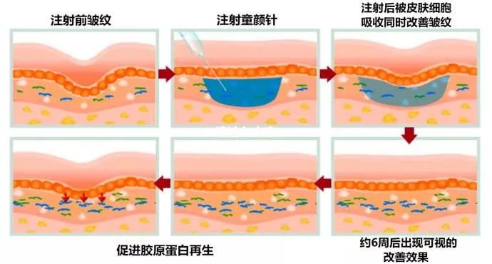 润百颜水光“贵”在哪里？和普通水光有什么区别