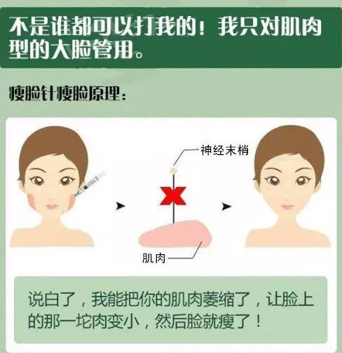 美莱医院v脸针介绍
