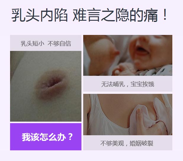 美莱医院乳头内陷怎么办