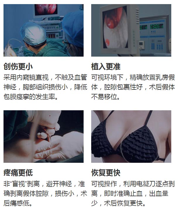 美莱胸部整形医师汪灏