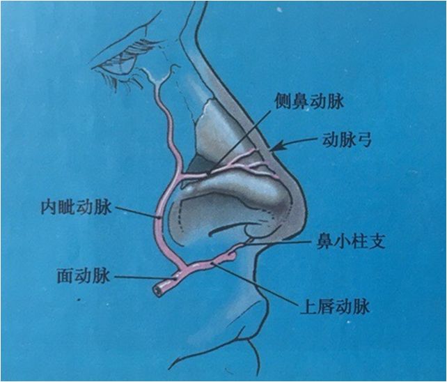 玻尿酸能不能注射鼻头