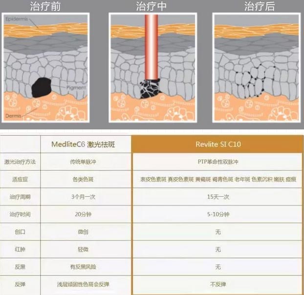 美莱祛斑c10是什么