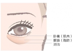 美莱怎样填充脂肪，才不会肿成面包超人？