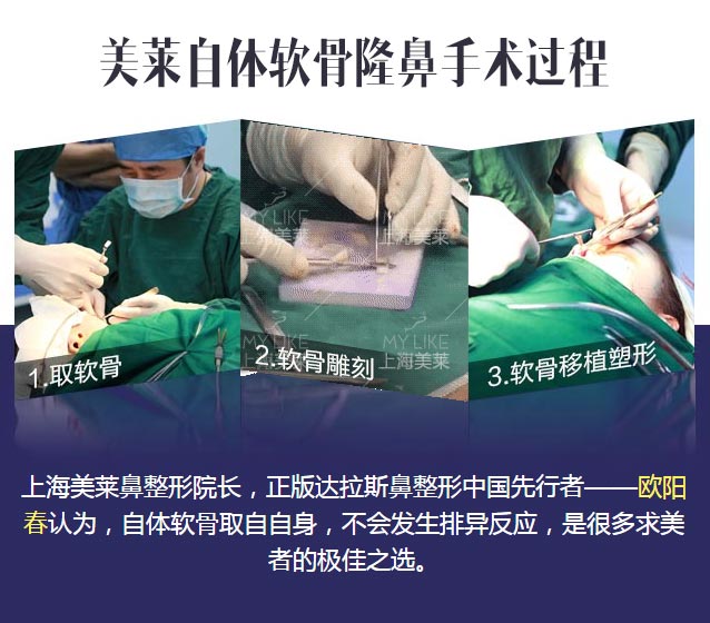 上海哪家医院可以做鼻子