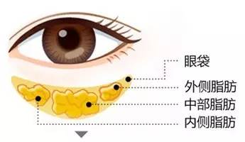 上海美莱眼部整形各方面塑造您靓亮之美