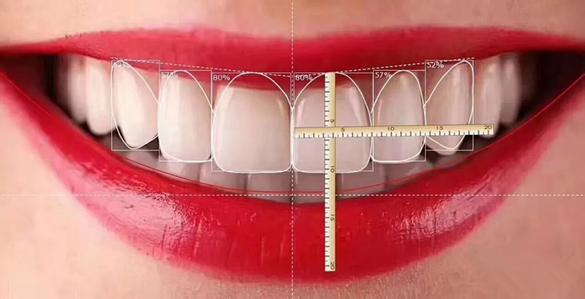 美莱医疗美容牙齿贴面修复能维持多久