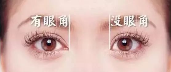 开眼角和不开眼角的区别有多大