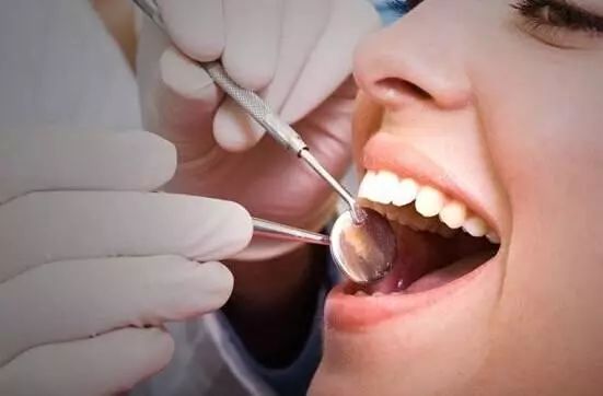 上海定期洗牙能预防蛀牙吗