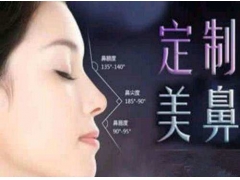 上海做鼻翼整形术需要多少钱
