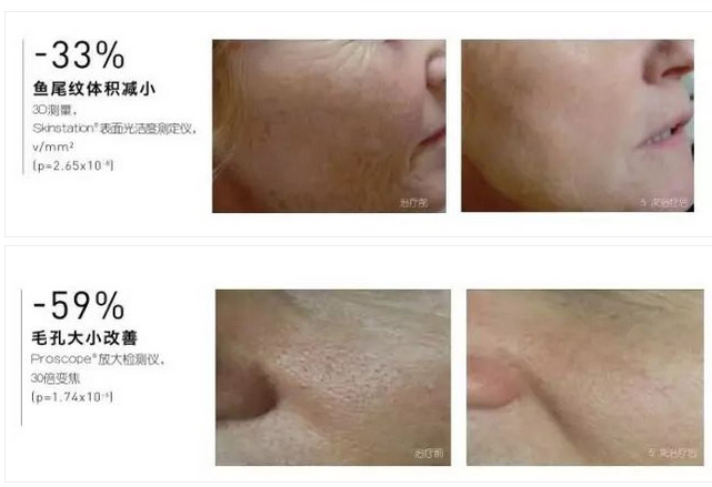 水光什么品牌比较好