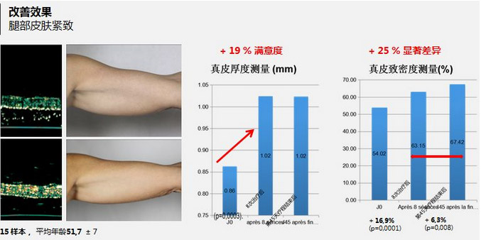 美莱抗衰老的“水光”究竟为何饱受称赞