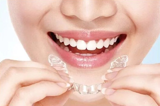 为什么很多人都选择隐适美做牙齿矫正