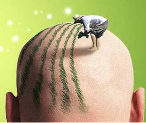 上海种植头发哪家好