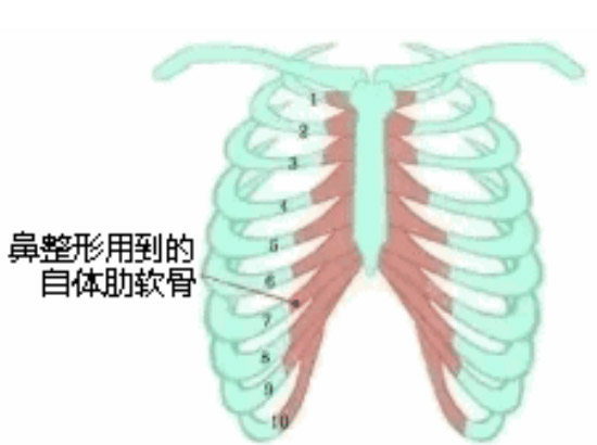 隆鼻这么多材料我们应该怎么选美莱