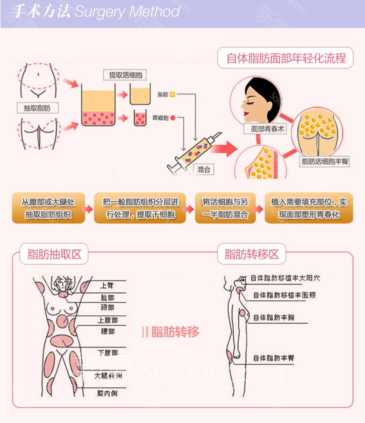 做完面部填充后会不会出现下垂