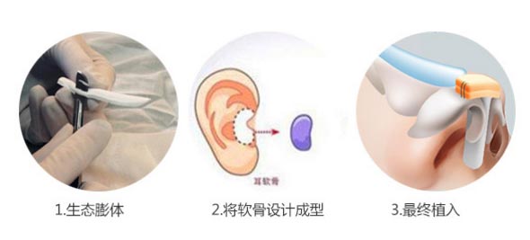 上海隆鼻整形医院哪里好