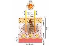 上海美莱提醒你：祛斑你都踩了哪些坑