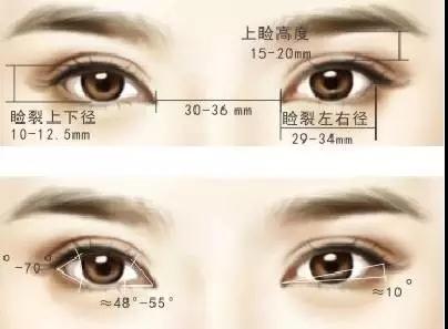 割双眼皮后如何消肿