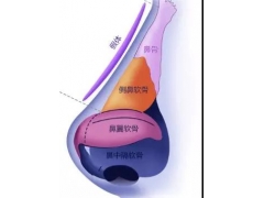 美莱做的膨体隆鼻会比硅胶隆鼻自然吗