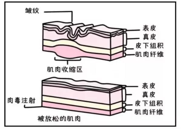 [美莱微整形说]注射瘦脸一定会脸僵吗