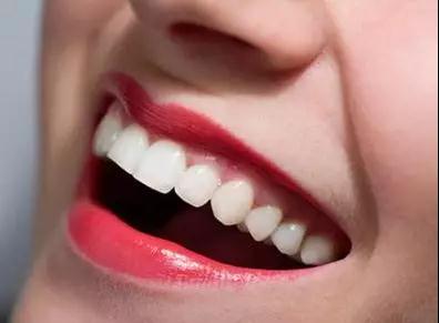 做了冷光美白牙齿会有哪些其他影响吗