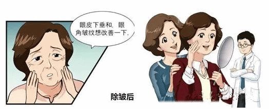 鱼尾纹很深怎么办如何解决