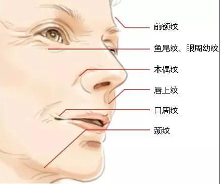 上海有什么方法能够消除皱纹