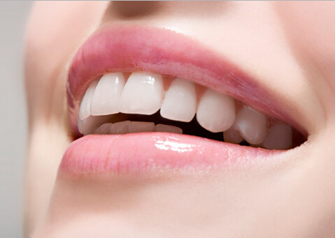 上海牙齿不齐牙齿矫正需要多少钱