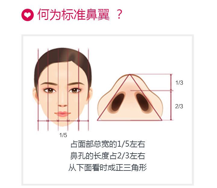 上海地区做鼻翼缩小手术价格贵不贵