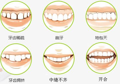 牙齿突出哪里可以做矫正，价格贵不贵