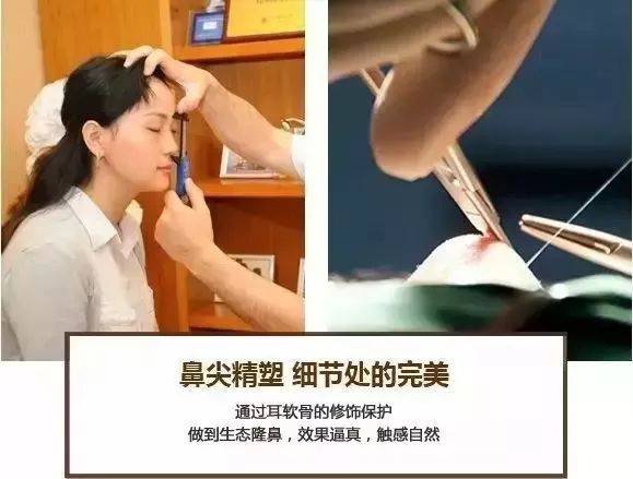 隆鼻失败？不满意？别急，在美莱还能重新变美