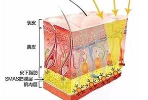 上海整形美容医院一般做激光除皱要花费多少