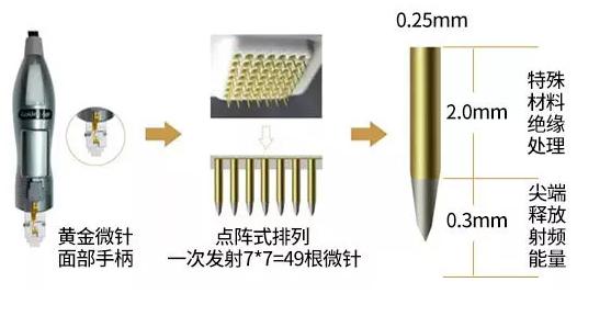 在美莱做黄金微针多少钱一次