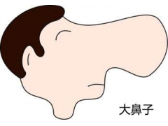 鼻头缩小需要多少钱在上海做